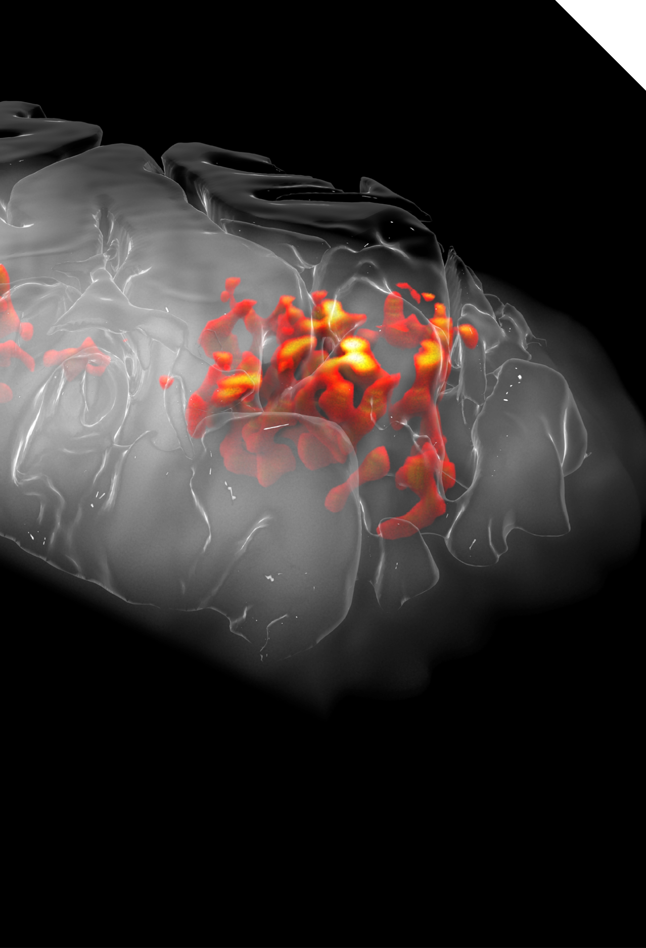 Perfusion_fMRI_all_layers_fade_no_labels_1930_high_res_0000_1 jpg