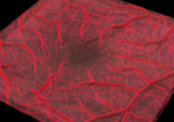1 Retinal_OCT_angiography_frame_0150 jpg