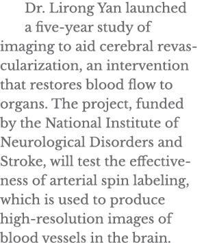 Dr  Lirong Yan launched a five-year study of imaging to aid cerebral revascularization, an intervention that restores   