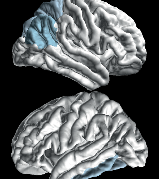 2Figure3AB_HY_Staging_Cortical_Results 7 png 