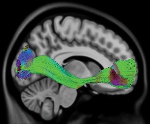 2 MeTA_workflow_report.ai