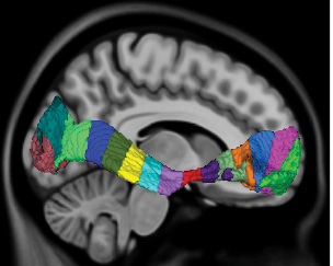 4 MeTA_workflow_report.ai