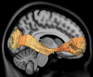 3 MeTA_workflow_report.ai
