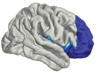 2 Kay Figure1 brains only 1.png